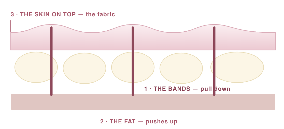Diagram of how cellulite forms: connective bands pull down, fat pushes up, skin on top dimples